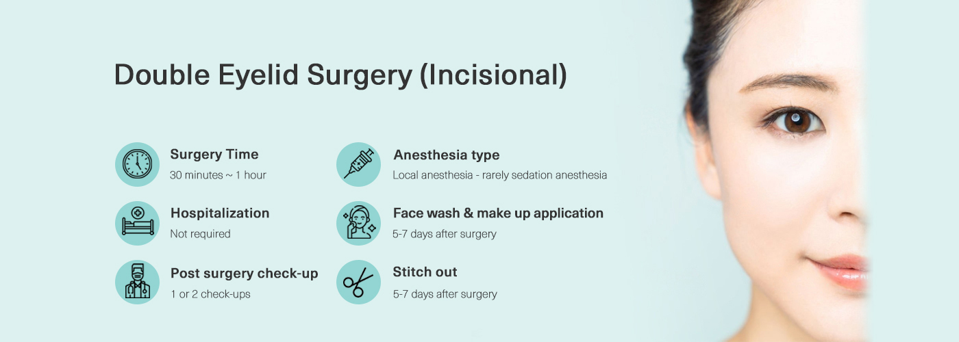 Double Eyelid Surgery (Incisional)
Surgery Time
30 minutes 1 hour
Anesthesia type
Local anesthesia - rarely sedation anesthesia
Hospitalization
Not required
Face wash & make up application
5-7 days after surgery
Post surgery check-up
1 or 2 check-ups
of
Stitch out
5-7 days after surgery